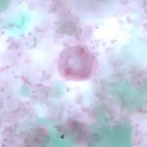 Binucleate form of a trophozoite D. fragilis