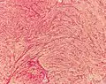 This variant of Van Gieson's stain distinguishes muscle (yellow) from connective tissue (red)