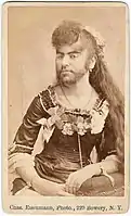 Photo of Annie Jones, a bearded lady, taken by Charles Eisenmann around 1900. The cause of Jones' hypertrichosis remains unknown.