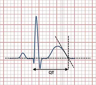 Measurement of the QT interval using the tangent method