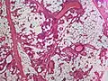 Small vessels in adipose tissue