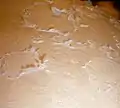 Skin peeling following burn